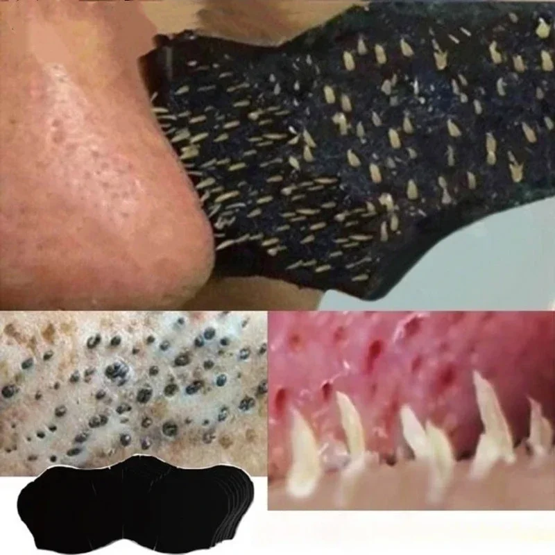 Charcoal Pore Strip - にきび除去マスク,鼻ストリップ,スキンケアパッチ,毛穴除去剤,シュリンククレンジング,ステッカー
