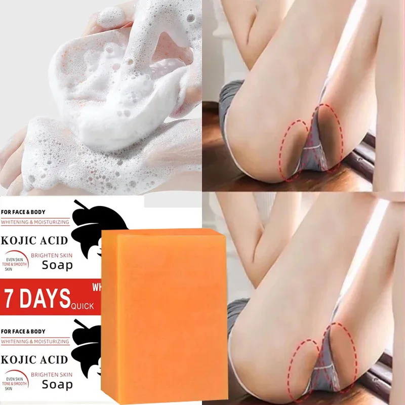 Kojic Acid Soap - コウジ酸ボディホワイトニングソープディープスキンブリーチングブライトンボディスクラブ膝陰部脇の下ホワイト栄養ケアソープ