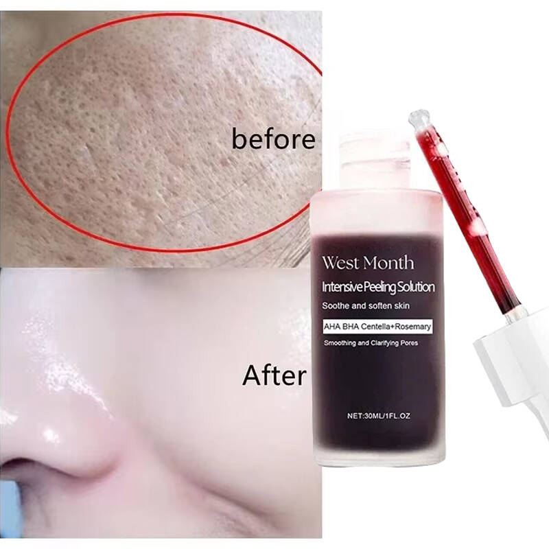 Tranexamic Acid Serum - シルクのような感触、フィルターのような見た目。 サリチル酸毛穴美容液 – 毛穴を引き締め、最小限に抑え、引き締め、滑らかにし、拡大した毛穴を改善します – 韓国製