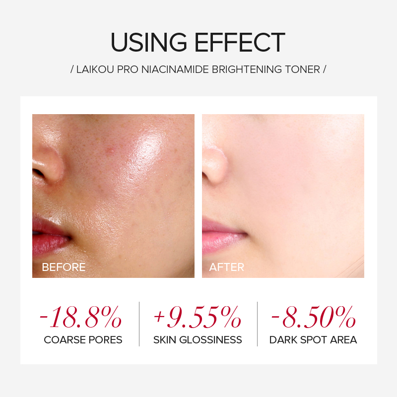 LAIKOU PRO ナイアシンアミド 4点セット ブライト - Niacinamide Brightening Serum のレビューと価格