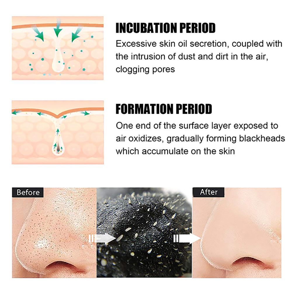10/20/50/100 個ディープクレンジング鼻毛穴ストリ - Charcoal Pore Strip のレビューと価格