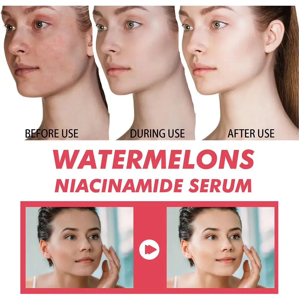 スイカグローナイアシンアミド保湿セラム、ヒアルロン酸ビタミン - Niacinamide Brightening Serum のレビューと価格