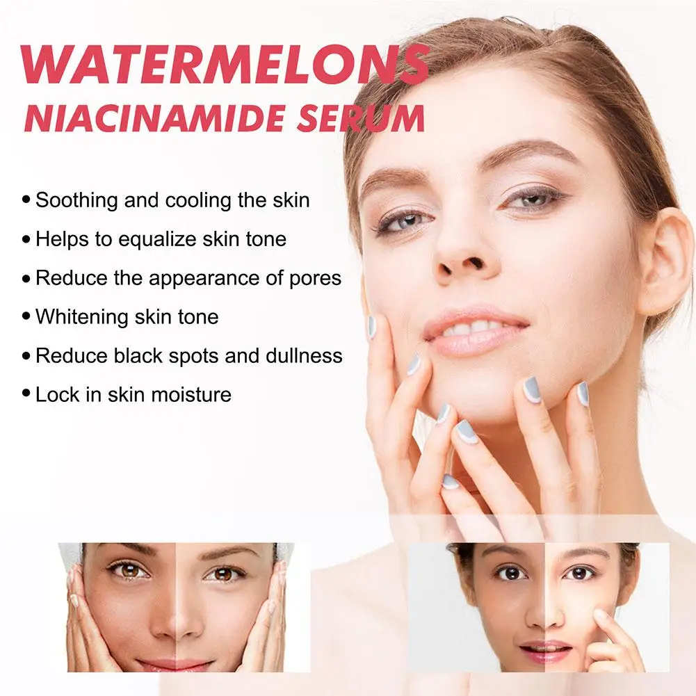 スイカグローナイアシンアミド保湿セラム、ヒアルロン酸ビタミン - Niacinamide Brightening Serum のレビューと価格