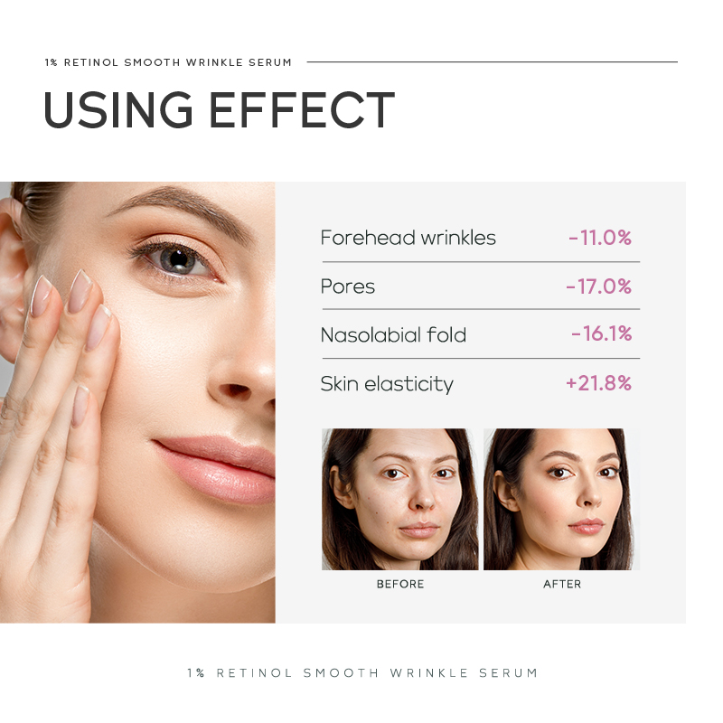 クイユム 1% レチノール スムース リンクル セラム 17 - Niacinamide Brightening Serum のレビューと価格