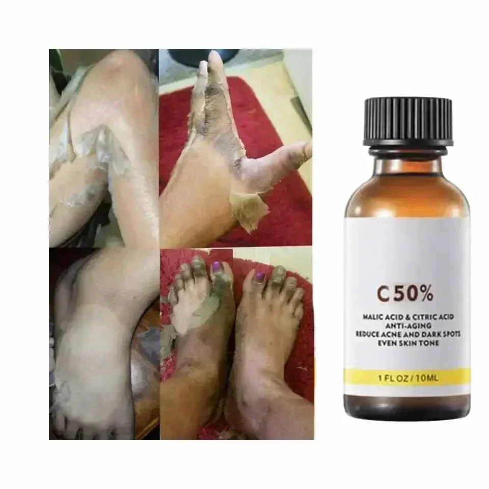 リンゴ酸とクエン酸配合のフェイシャルピール40%ピーリングセ - Tranexamic Acid Serum のレビューと価格